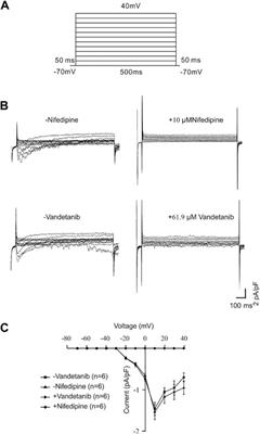 Vandetanib as a prospective anti-inflammatory and anti-contractile agent in asthma
